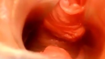 Pussy Close Up And Speculum