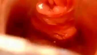 Pussy Close Up And Speculum